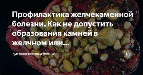 Благоприятное воздействие томатного сока на профилактику образования камней в желчном пузыре