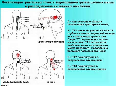 Болевые ощущения в затылке с одной стороны: как преодолеть дискомфорт