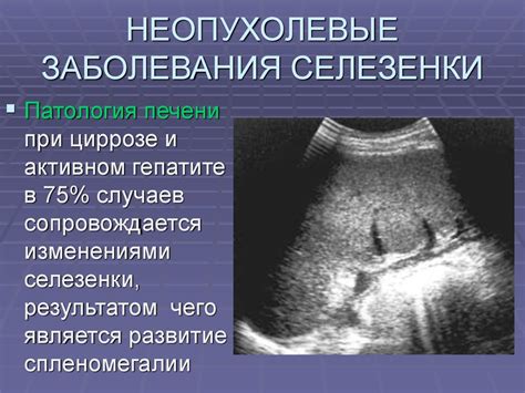 Болезни и дисфункции селезенки