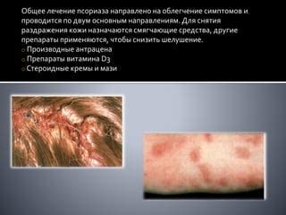 Влияние амбера на облегчение симптомов определенных заболеваний