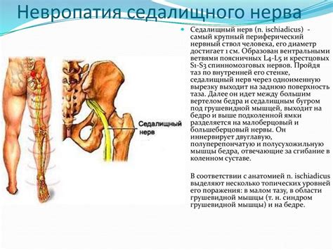 Влияние различных факторов на состояние седалищного нерва
