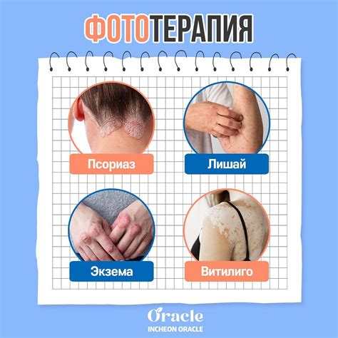 Воздействие соли на кожные заболевания, такие как экзема и псориаз