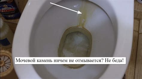 Возможность возникновения грязи и налета в унитазе из-за проблем в системе канализации