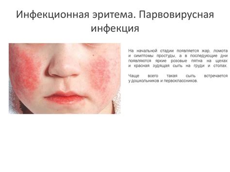 Возможные аллергические реакции, вызывающие появление кожных высыпаний и зуда на стопе