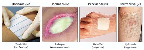 Воспаление раны после операции