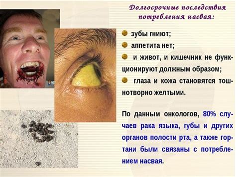 Вредность и последствия употребления плесневелой муки: опасности, которые нужно знать!