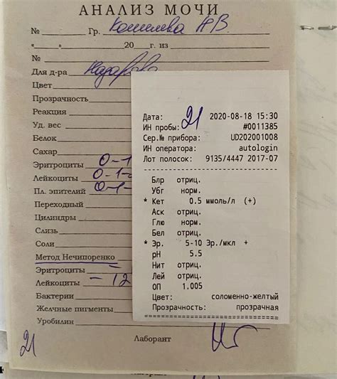 Выявление нарушений посредством общего анализа мочи