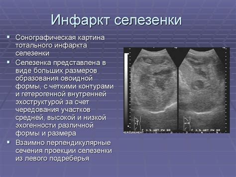 Диагностика и обследование некроза селезенки