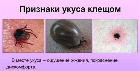 Диагностические процедуры и исследования для определения возможных последствий укуса клеща