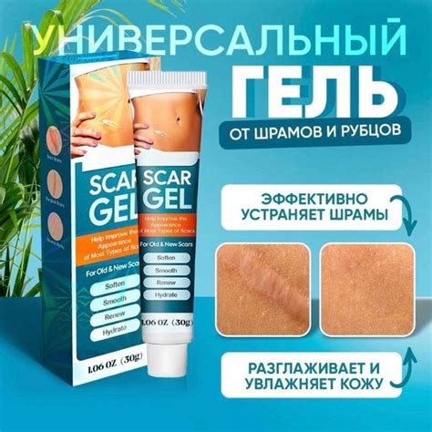 Дополнительные способы для усиления эффекта крема против растяжек и шрамов