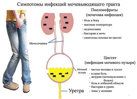 Другие симптомы, сопутствующие мутной моче