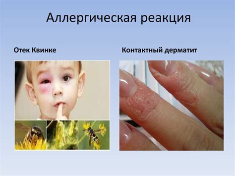 Избегаем аллергической реакции на перловку