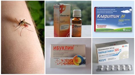 Использование препаратов для снятия судорог: оптимальное решение при укусе комара на области губы