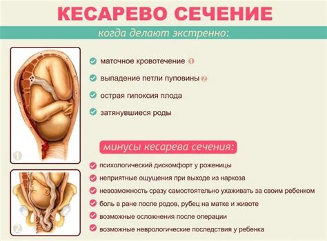 Кесарево сечение: особенности и условия применения