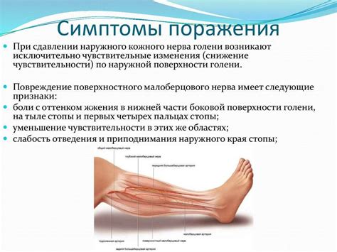 Компрессионная невропатия