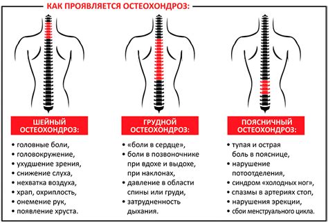 Лечение и профилактика проблем с небольшими формациями в структуре позвонков