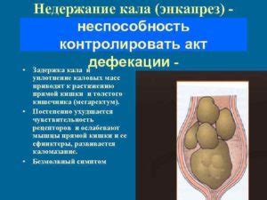 Методы лечения непроходимости каловых масс у взрослых