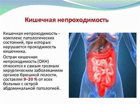 Непроходимость кишечника у пожилых людей