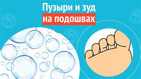 Обзор основных причин, ведущих к образованию несовершенств на подошвах