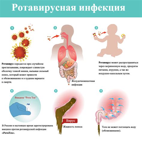 Определение первых признаков ротовирусной инфекции у ребенка 9 месяцев
