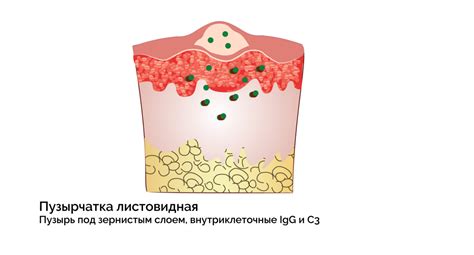 Основные признаки наличия пузырей и их последствия