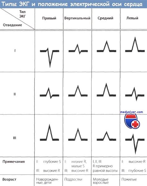 Основные причины возникновения неопределенной электрической позиции сердца