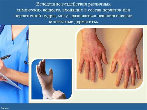 Особенности применения антисептических растворов при борьбе с неприятным ощущением в области горла