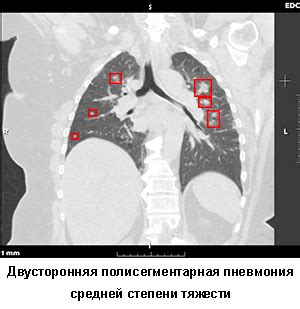 Особы медицинские клиники, предлагающие услугу КТ органов дыхания