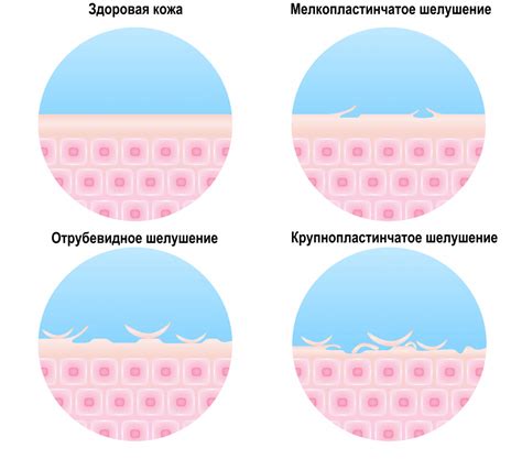 Повышение риска сухости и шелушения кожи