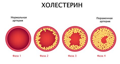 Поддержание нормального уровня холестерина