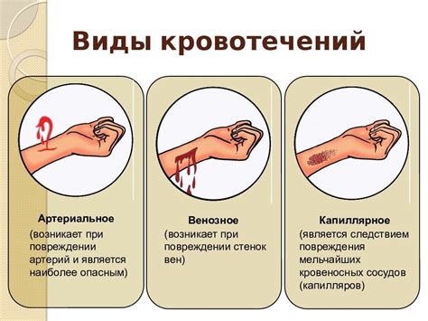 Последствия выстрела в области ягодицы до колена: неотложные действия после остановки кровотечения