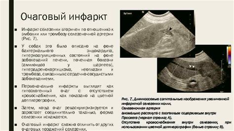 Последствия некроза селезенки и прогнозы