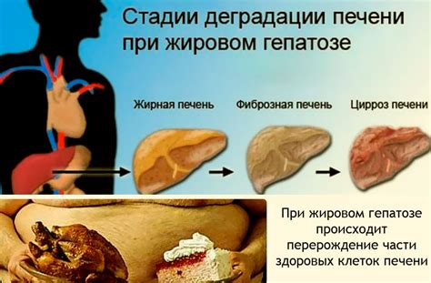 Последствия неоплазии печени