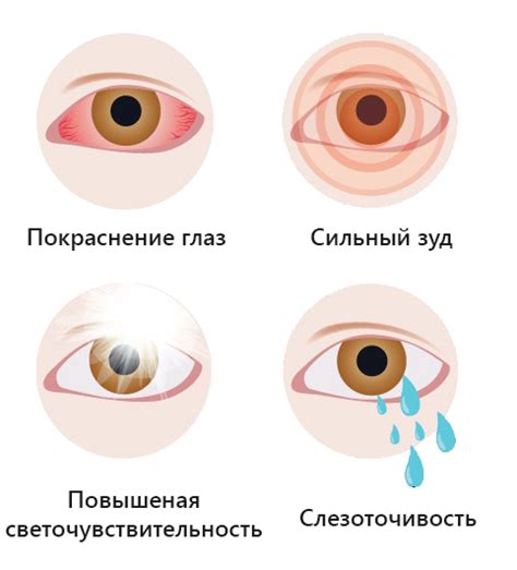 Превентивные меры: избегайте контакта с аллергенами