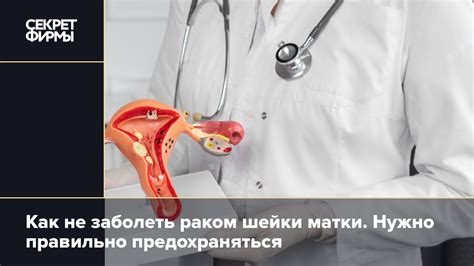 Причины недостаточного раскрытия шейки матки в ходе схваток