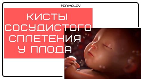 Причины неоднородности сосудистых сплетений