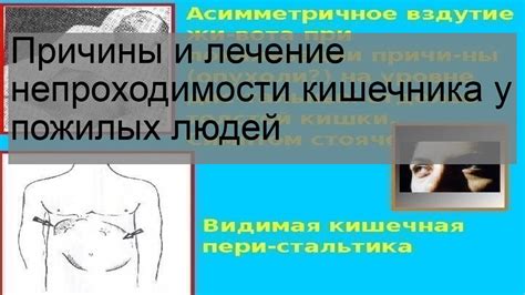 Причины непроходимости кишечника у пожилых людей