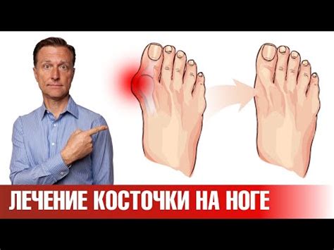 Профилактика давления кед на ноги