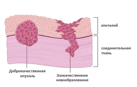 Ранняя выявление злокачественной опухоли: ключевые признаки и подходы к диагностике