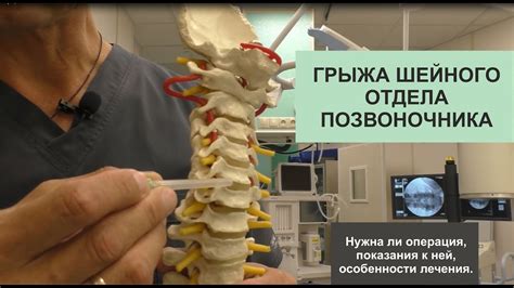 Реабилитация и методы восстановления функций после воздействия на шейный отдел позвоночника
