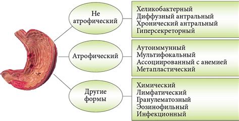 Регулирование оптимальной кислотности желудка: важность поддержания баланса