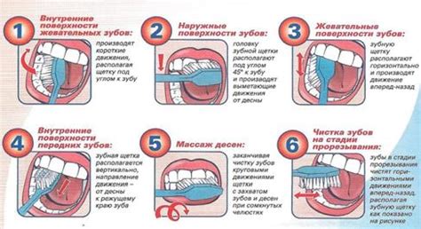 Роли зубной щетки и зубной нитки в предотвращении проблем полости рта при переедании