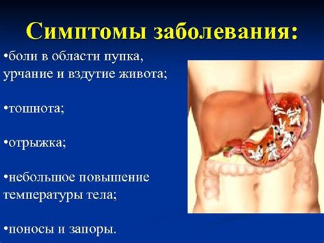 Роль перитонеума в области пупка и распространенные заболевания