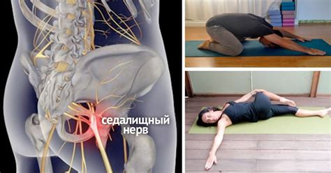 Роль седалищного нерва в организме и его значение