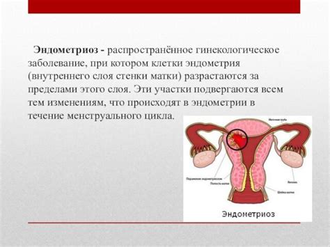 Симптоматика и обнаружение изменений в тканях внутреннего слоя матки