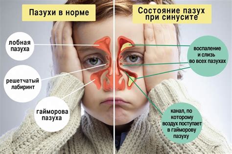 Состояние и последствия нарушенной слышимости при отите