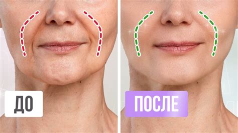 Способы предупреждения и снижения появления темного круга в области носогубных складок