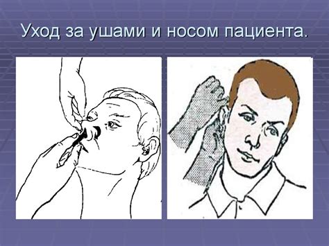 Уход за носовыми пролетами при появлении прозрачной жидкости
