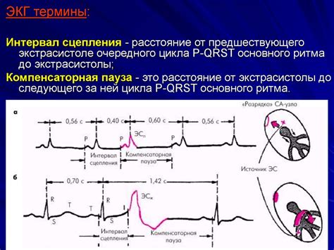 Факторы, влияющие на ускорение сердечного ритма