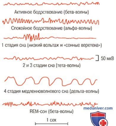 Феномен снов в контексте мозговой активности